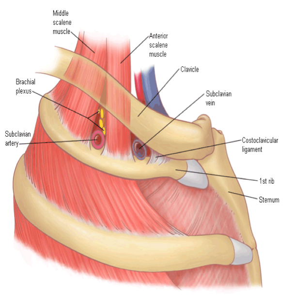 What is Thoracic Outlet Syndrome?
